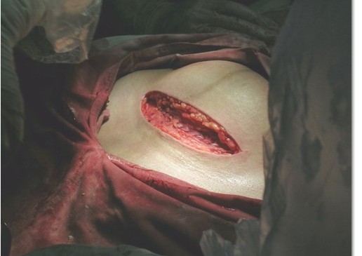 生孩子全过程,看了你会哭的(真实画面,慎入)