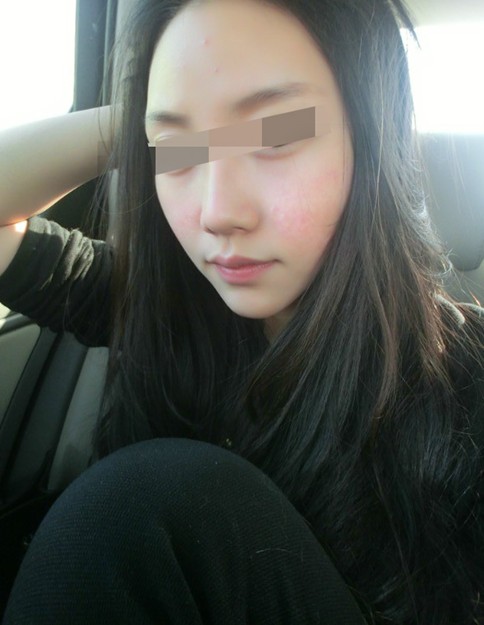 脸上皮肤过敏怎么办,避冬的燕子飞舞蹁蹁