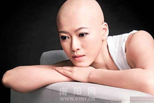 前港姐林淑敏患乳癌 化疗后一晚头发全掉光